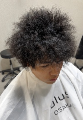 施術事例 3